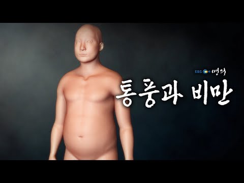 [명의 의학백과📖] 통풍과 비만