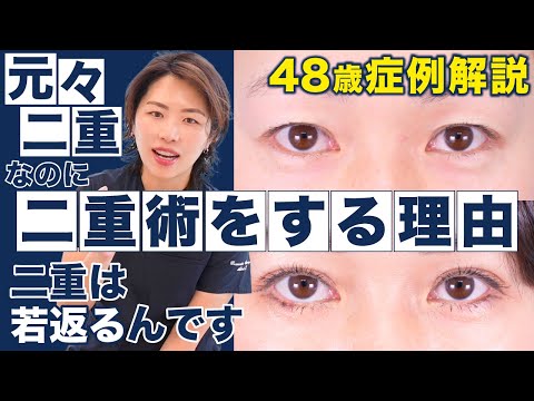 【48歳症例解説】二重は若返る！二重の人が二重埋没法を受ける理由【湘南美容外科　キム先生】