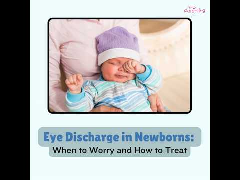 Eye Discharge in Babies: Causes & Treatment