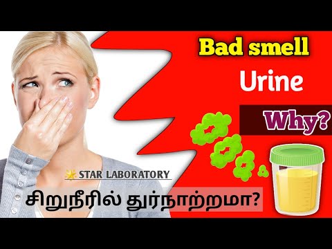 Bad smell in urine why? | சிறுநீரில் துர்நாற்றமா? | Bad smell urine problem in tamil | #urineproblem