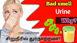 Bad smell in urine why? | சிறுநீரில் துர்நாற்றமா? | Bad smell urine problem in tamil | #urineproblem