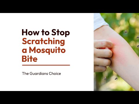 3 Ways to Stop Scratching a Mosquito Bite | The Guardian's Choice