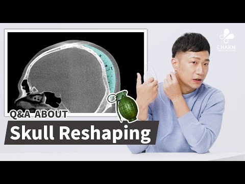 Surgery Support｜Skull Reshaping｜Occiput Augmentation