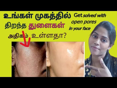 Biotique Toner review tamil/How to get rid of open pores on face? Reduce open pores by using Toner?