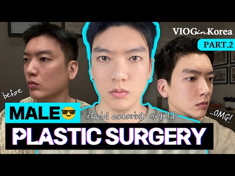 PLASTIC SURGERY FOR MEN?! (with Brian Tran)