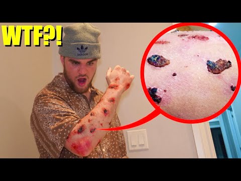 if you see this GROWING ON YOUR SKIN.... CALL 911 and get help immediately!! ( WTF)