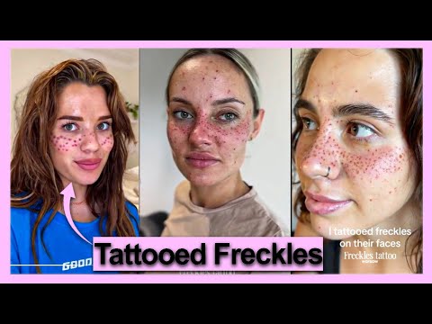 Tik Tokers are Tattooing Freckles On Their Face.