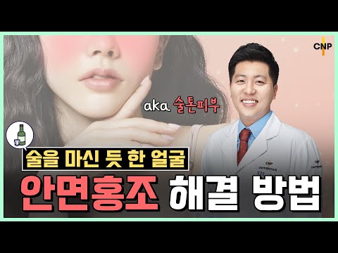 괜히 취해 보이는 술톤 피부! 괜히 부끄러워 보이는 부끄톤 피부! 안면홍조 해결방법!