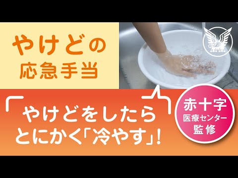 【大正健康ナビ】覚えておきたい「やけど」の応急手当