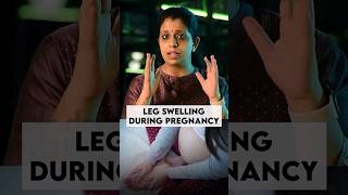 Leg swelling during pregnancy #shorts #pregnancy