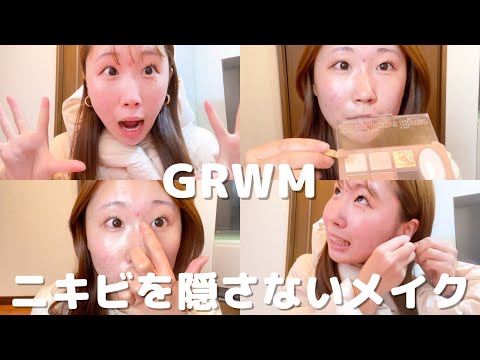 【GRWM】ニキビを隠さないメイク（ニキビ/ニキビ跡/赤ら顔/酒さ様皮膚炎 に悩み私）