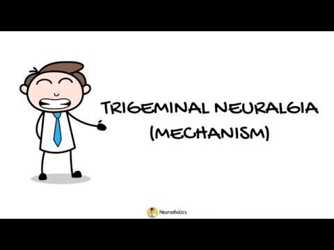 Trigeminal Neuralgia Mechanism