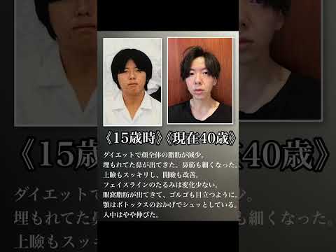 ダイエットと加齢で顔は変わります。美容整形は本当に必要な時に検討しましょう。本当に必要な時は全力でサポートします^_^