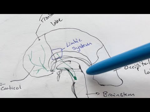 How psychosis occurs in Schizophrenia (as simple as I can make it)