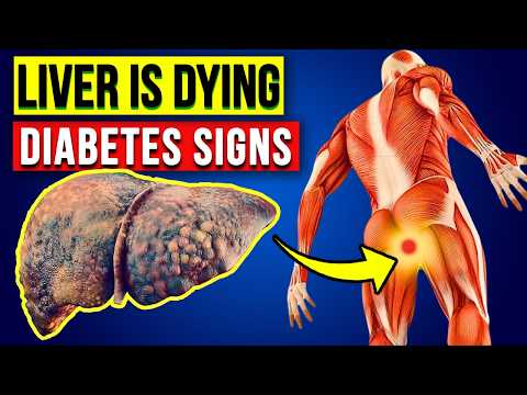 LIVER is DYING! 6 Weird Signs Diabetes is DAMAGING Your LIVER