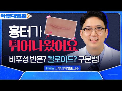 흉터가 점점 커지고, 튀어나오는 것 같아요😰 저… ‘켈로이드’일까요? (feat. 피부과 VS 성형외과 고민된다면?) | 피부과 박영준 교수 [아주대병원TV]