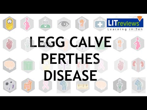 Legg Calve Perthes Disease