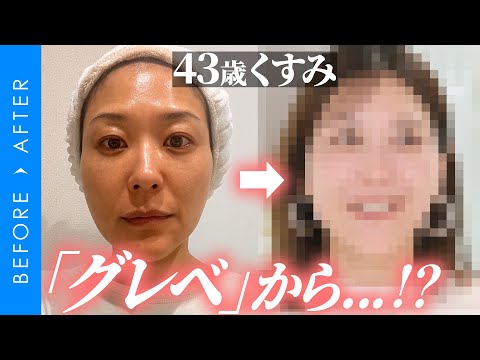 ビフォアフ：43歳くすみ「グレベ肌」が輝き出すまで。プロ監修美肌ストーリー【後編】