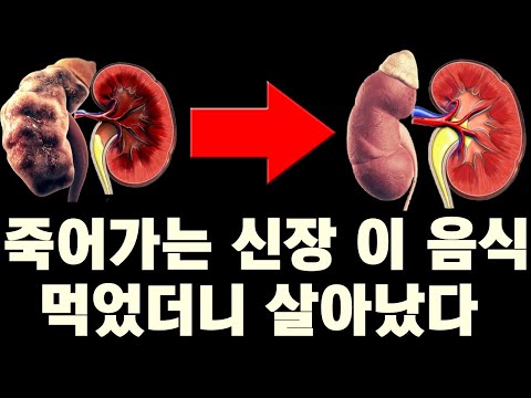 '이 음식들' 먹었더니 망가진 신장이 살아났다. 신장에좋은음식