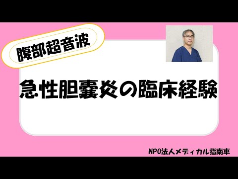 急性胆嚢炎の臨床経験ー腹部超音波ー