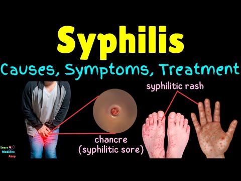 Syphilis: Causes, Signs, Symptoms, Diagnosis, Treatment and Prevention