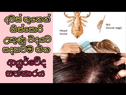 How to get rid of lice and dandruff /හිස්සොරි සහ උකුණන්ට සාර්ථකම විසදුම් /neem oil and hair mask