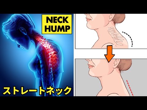 How to Fix a Neck Hump and Slim Face | You can do it sitting