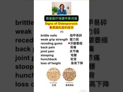 Signs of Osteoporosis 骨质疏松症的症状 (1) (Click the link to see more)