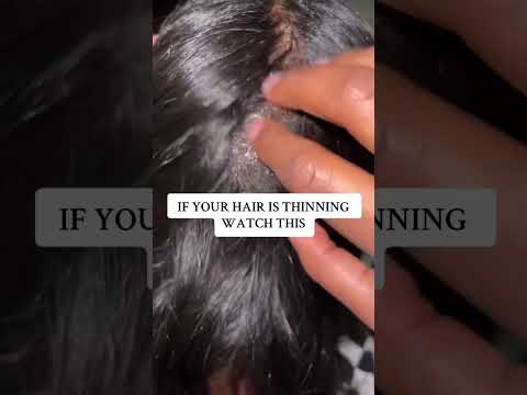 If your hair is thinning watch this #naturalhair #haircare #hairgrowth #curlyhair #4chair