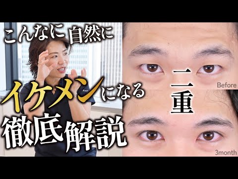 【ヤバすぎ】埋没二重でこんなにイケメンになる！自然すぎる二重整形を金先生が症例解説します【湘南美容外科　キム先生】