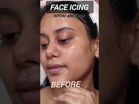 Look at the Difference Before/ After face Icing ☃️