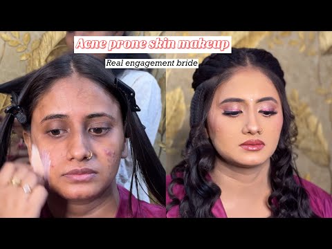 Acne prone skin makeup | Engagement makeup tutorial on oily skin | Real work | Tips for Active acne