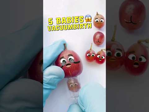 5 BABIES and Conjoined Twins😱❤️ Grape Vacuumbirth (No c-section) #fruitsurgery #shorts #cute #food