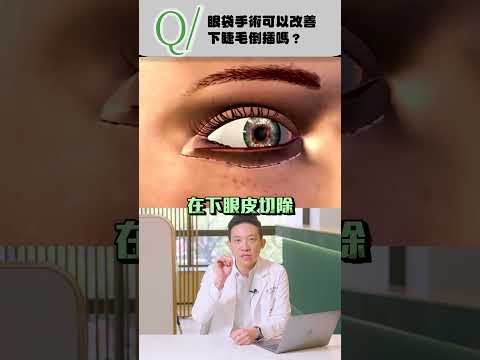 下睫毛倒插...眼袋手術有幫助嗎？#眼袋 #眼袋手術 #睫毛倒插 #整形 #整形外科 #醫美 #醫美診所 #林子宇 #林子宇醫師 #新聖整形外科