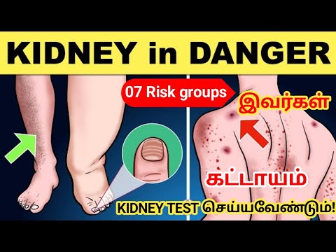 சிறுநீரக நோய் ஆபத்து உள்ளவர்கள் | kidney failure risk people in tamil | STAR LABORATORY