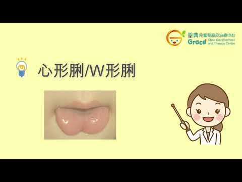 【發音及口部肌肉發展】甚麼是黐脷筋？ Speech Therapy Tongue Tie