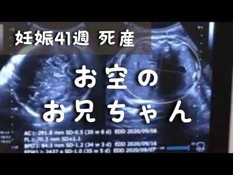 【臨月 死産】死産前後を記録したブログ公開 お空のお兄ちゃん