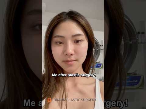 Anyone knows who she is?😍 #fyp #glowup #plasticsurgery #lesserafim #yunjin #explore