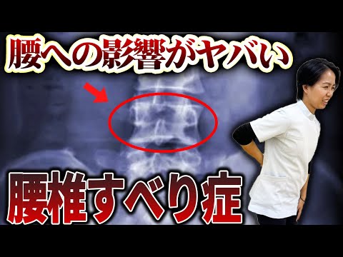 腰椎すべり症の根本対策はこれ！今日から誰でもできる簡単トレーニング5選！