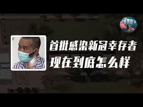 首批感染新冠倖存者怎麼樣？暴瘦四十公斤器官衰竭，生不如死！