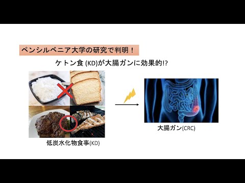 ケトン食 (ケトジェニックダイエット)が大腸ガンに効果的!?