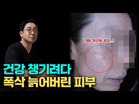 기미, 주근깨, 흑자, 잡티... 급격하게 늙어 버린 피부 다시 돌릴 수 있을까? / 오가나의 피부교정(색소침착)