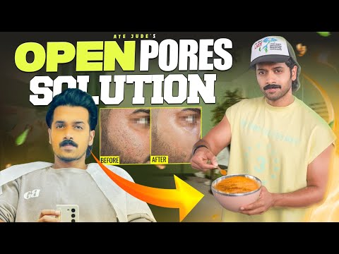 5 *OPEN PORES* Removal Tips At Home #video