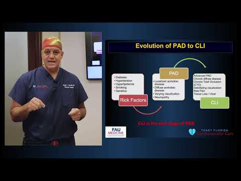 Joseph Ricotta, MD, MS, DFSVS, FACS | PAD Awareness Presentation