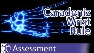 Caradeniz Wrist Rule | Wrist Fractures