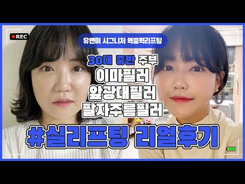 [ 리얼후기 ] 30대실리프팅 / 팔자주름  / 실리프팅후기  /  이마필러 / 앞광대필러