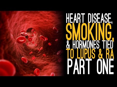 Heart Disease, Smoking, and Hormones Tied To Lupus & RA [Part 1]