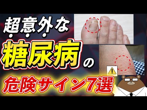 放置厳禁！絶対に見逃さないで！知らないと後悔する糖尿病の危険な7つの症状とは？