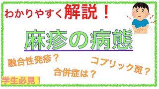 教科書をわかりやすく！「麻疹ってどんな病態？」風疹との違いや国試過去問をわかりやすく解説！