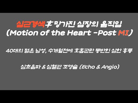 심근경색후 망가진 심장의 움직임 (Motion of the Heart - Post MI) : 심장 초음파 및 조영술 (Echo & Angio) #shorts  #심근경색  #MI